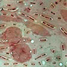 klebsiella pneumoniae gram stain image